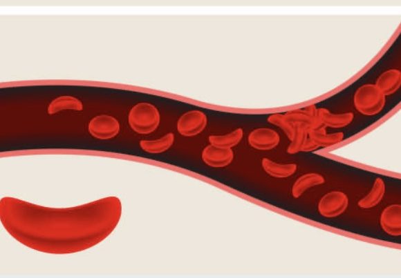 Breaking the Chains of Stigma: Fighting for Sickle Cell Warriors' Rights to Care. IMG_6765